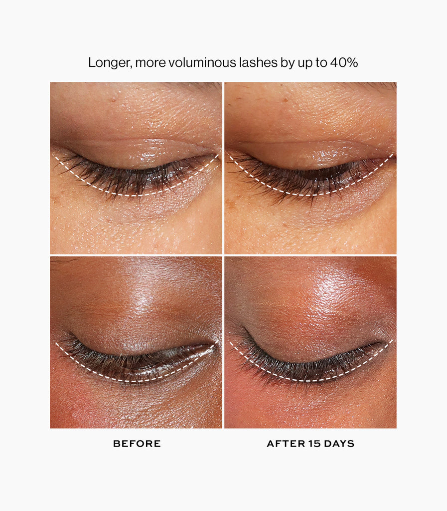 hyperboost lash serum before and after