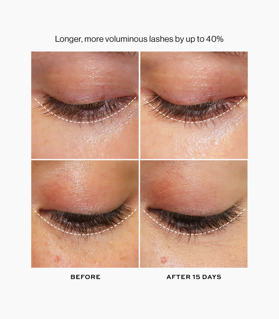 hyperboost lash serum before and after